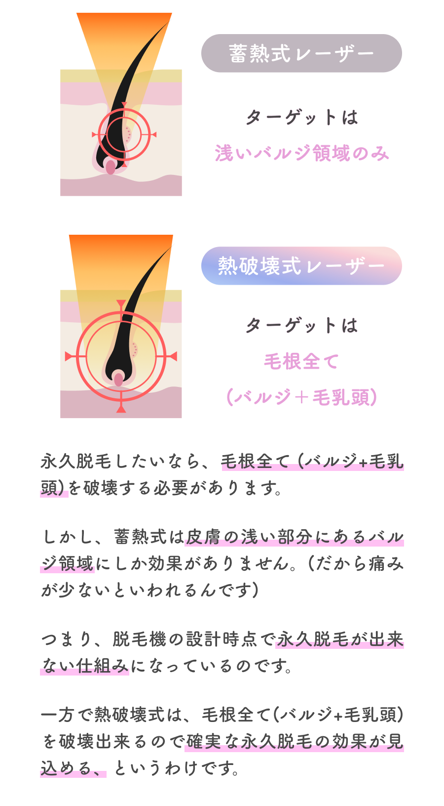 蓄熱式レーザー：ターゲットは浅いバルジ領域のみ。熱破壊式レーザー：ターゲットは毛根全て（バルジ＋毛乳頭）